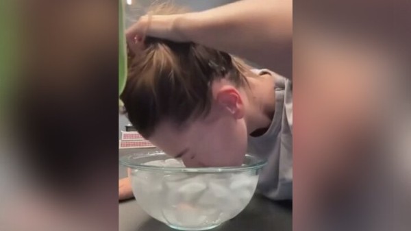 Врач Скорогудаева: окунание лица в ледяную воду может вызвать обострение розацеа Врач Скорогудаева: окунание лица в ледяную воду может вызвать обострение розацеа