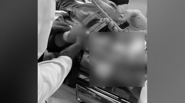 Мальчик в Красногорске пострадал от взрыва, когда поднял деньги с земли Мальчик в Красногорске пострадал от взрыва, когда поднял деньги с земли